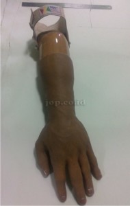 tangan palsu untuk pasien surabaya